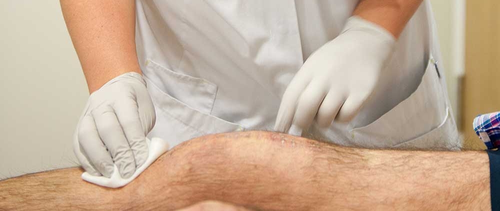 Injectie knie artrose Injectie knie artrose