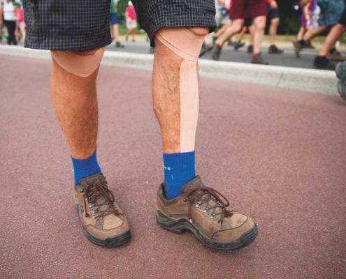 Knieprothesen van meneer Wolf Knieprothesen van meneer Wolf