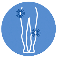 Orthopedie heupklachten